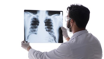  lékař při pohledu na rentgenový obraz plic pacienta.